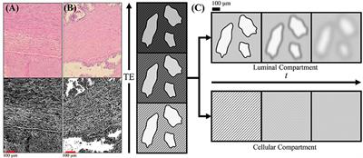 Characterization of Prostate Microstructure Using Water Diffusion and NMR Relaxation